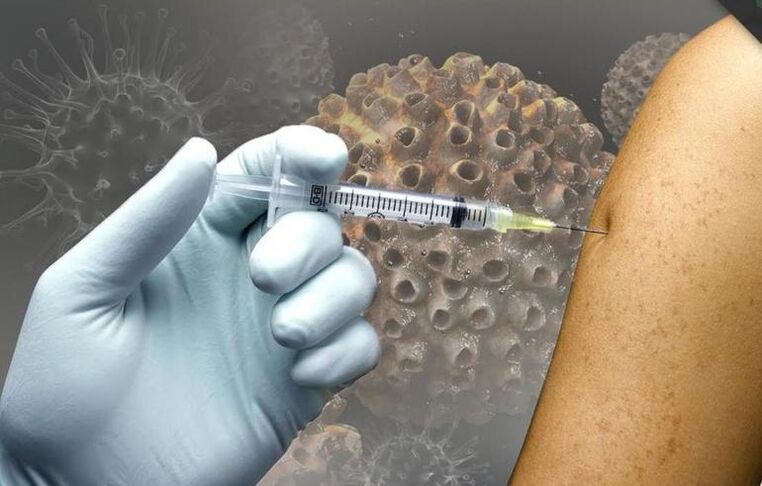 Vakcinázás onkogén HPV törzsek ellen