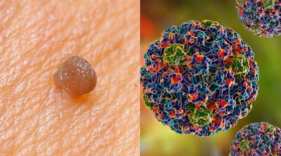 A HPV átviteli útvonalai